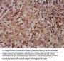 MOV10L1 Antibody