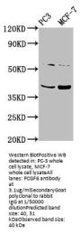 PCGF6 Antibody