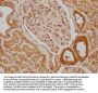 SNX5 Antibody