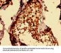 MKRN2 Antibody