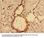 MKRN2 Antibody