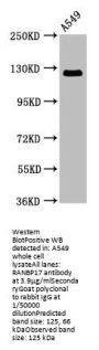RANBP17 Antibody