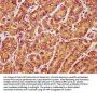 RANBP17 Antibody
