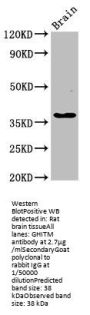 GHITM Antibody