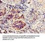 HIPK3 Antibody