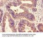 HIPK3 Antibody