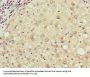 RHOJ Antibody