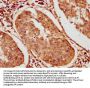 BICC1 Antibody