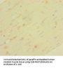 LRRC19 Antibody