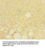 LRRC19 Antibody