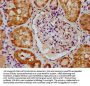 CNNM2 Antibody