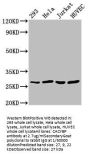 CACYBP Antibody