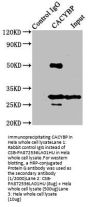 CACYBP Antibody