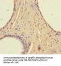 RAVER2 Antibody