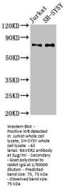 RAVER2 Antibody