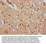 DMAP1 Antibody