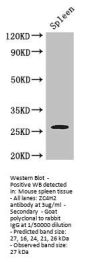ZC4H2 Antibody