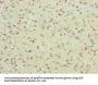 FBXO6 Antibody
