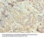 TUBG2 Antibody