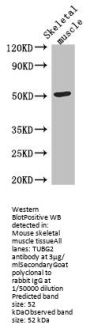 TUBG2 Antibody