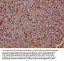 INPP5E Antibody