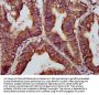 BABAM2 Antibody