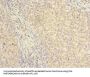 NKIRAS2 Antibody
