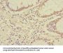 UBAP1 Antibody