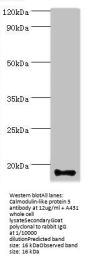 Rabbit anti-human Calmodulin-like protein 5 polyclonal Antibody(CALML5)