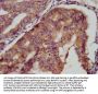 KCMF1 Antibody