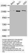 LARS Antibody