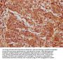 MIEN1 Antibody