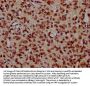 NDC1 Antibody