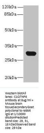 C1QTNF6 Antibody