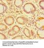 TDRD1 Antibody
