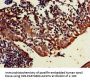 TRIM5 Antibody