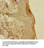 S100A14 Antibody