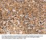DCLK1 Antibody