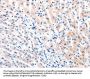 MTOR Antibody