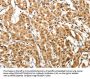 MAP1A Antibody