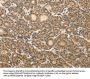 MAP1A Antibody