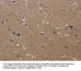 PIK3CG Antibody