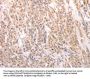 ACIN1 Antibody