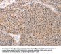 ACIN1 Antibody