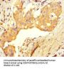 UBE2T Antibody