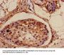 NDUFA4L2 Antibody