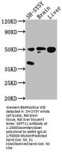 SEPT11 Antibody