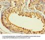 ASF1B Antibody