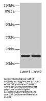 ASF1B Antibody