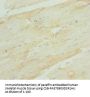 RBFOX1 Antibody
